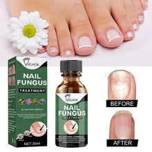 Load image into Gallery viewer, 1 Bottle 15ml Magic Fast Remover Gel Nail Polish Clean UV Soak Off Degreasr For Manicure Layer Nail Art Removal Semi-permanet