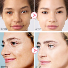 Load image into Gallery viewer, Original AHA 30%+ BHA 2% Peeling Solution Niacinamide Hyaluronic Acid B5 Alpha Arbutine Buffet Lactic Acid Caffeine Skin Care