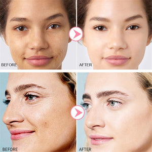 Original AHA 30%+ BHA 2% Peeling Solution Niacinamide Hyaluronic Acid B5 Alpha Arbutine Buffet Lactic Acid Caffeine Skin Care