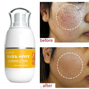 Dark Spot Corrector Moisturizing Effectively Removes Spots Spots Chloasma Age Spots Skin Brightening 40G Dark Care Sun Whit I3Z1