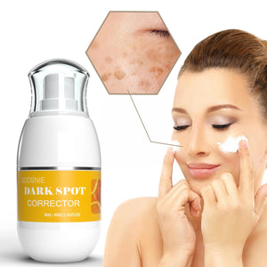 Dark Spot Corrector Moisturizing Effectively Removes Spots Spots Chloasma Age Spots Skin Brightening 40G Dark Care Sun Whit I3Z1