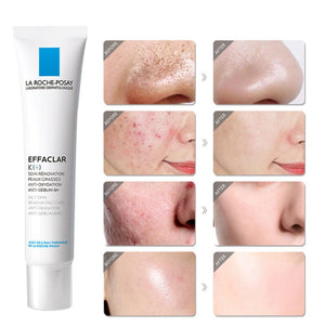 Effaclar K+ La Roche Posay Acne Spots Removal Cream Removing Blackheads Control Oil Shrinking Pores Face Care Serum Gel 40ml
