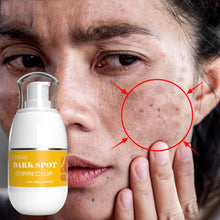 Load image into Gallery viewer, Dark Spot Corrector Moisturizing Effectively Removes Spots Spots Chloasma Age Spots Skin Brightening 40G Dark Care Sun Whit I3Z1