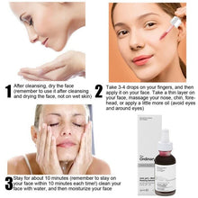 Load image into Gallery viewer, Original AHA 30%+ BHA 2% Peeling Solution Niacinamide Hyaluronic Acid B5 Alpha Arbutine Buffet Lactic Acid Caffeine Skin Care
