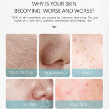 Load image into Gallery viewer, Effaclar K+ La Roche Posay Acne Spots Removal Cream Removing Blackheads Control Oil Shrinking Pores Face Care Serum Gel 40ml