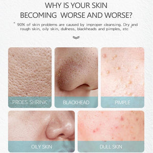 Effaclar K+ La Roche Posay Acne Spots Removal Cream Removing Blackheads Control Oil Shrinking Pores Face Care Serum Gel 40ml