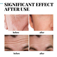 Load image into Gallery viewer, EELHOE 30gCollagen Anti Wrinkle Creams for Men Man Hyaluronic Acid Vitamin E Lighten Cream Beauty Moisturizing Facial Care TSLM1