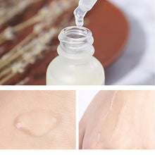 Load image into Gallery viewer, 10 kinds  Face Makeup Peeling Solution AHA 30% + BHA 2% Acne Removing Serum Repair Hyaluronic Acid Face Skin Care 30ml