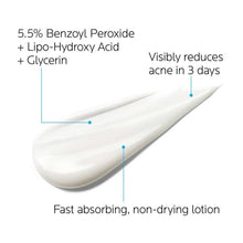 Load image into Gallery viewer, La Roche Posay Effaclar Duo Whitening Acne Removal Cream Acne Spots Oil Control Acne Moisturizing Cream Face Skin Care
